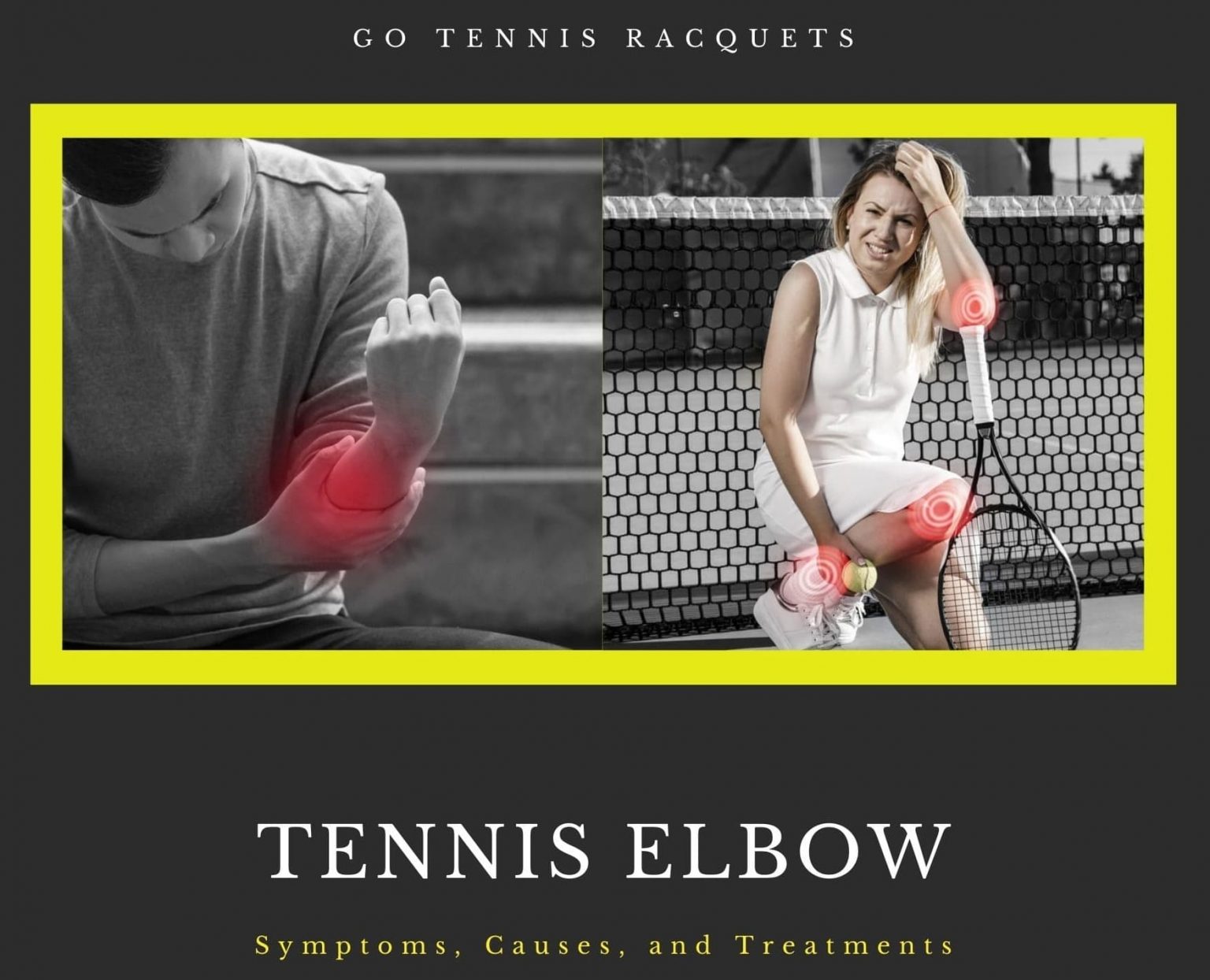 Tennis Elbow Symptoms Treatment Surgical Or Non Surgical