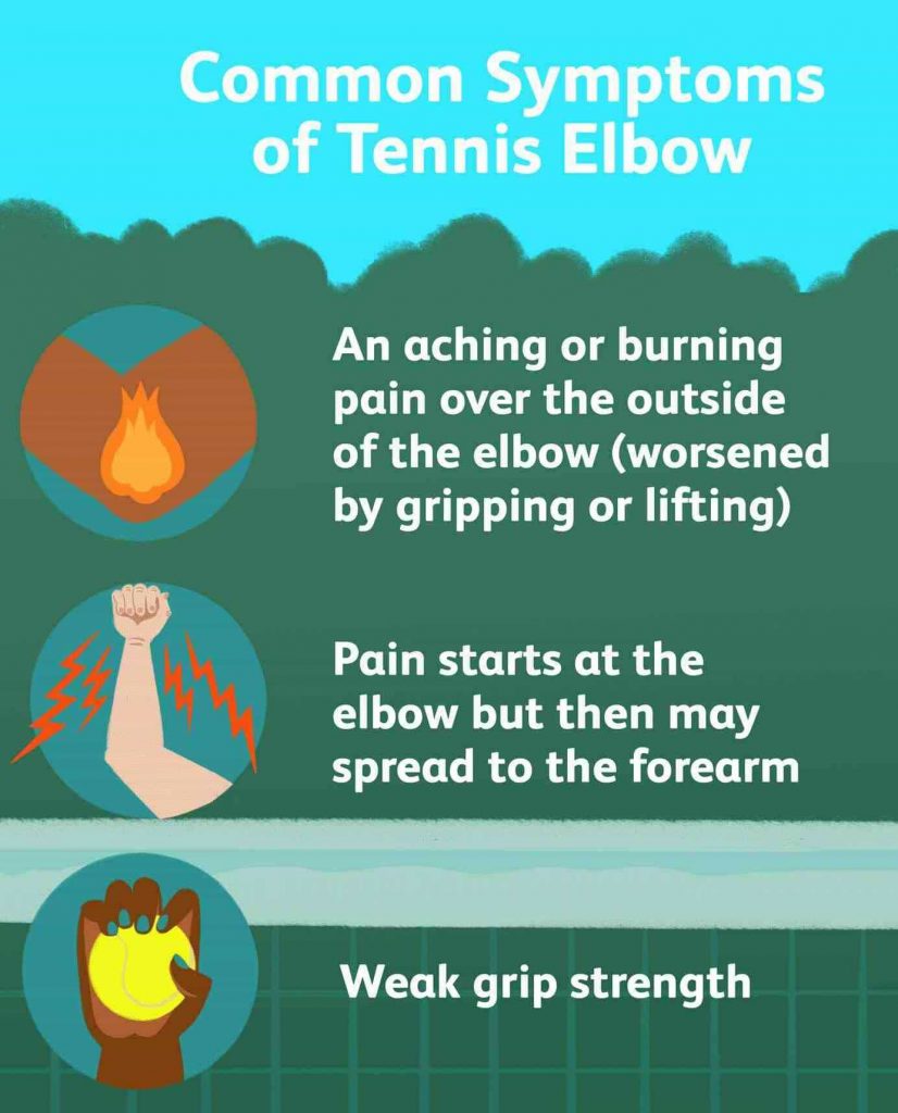 Tennis Elbow Symptoms